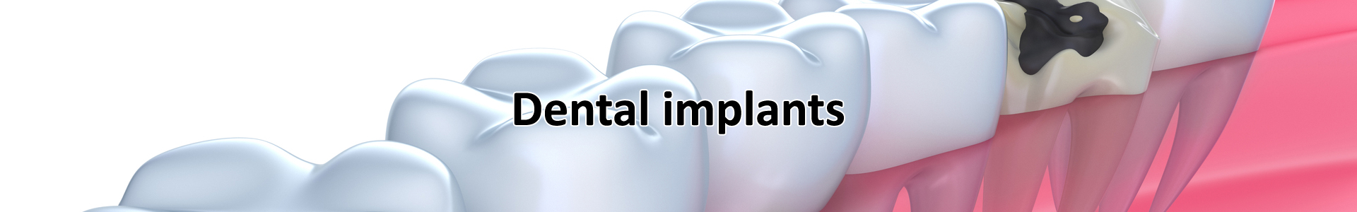 Dental Services in Visalia