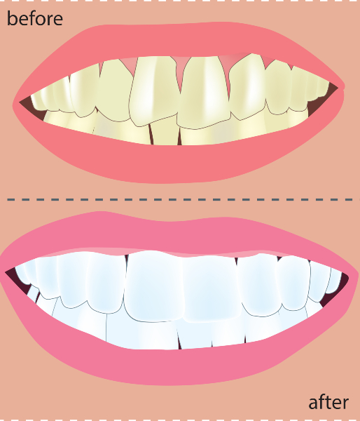 COSMETIC DENTISTRY AESTHETIC TEETH