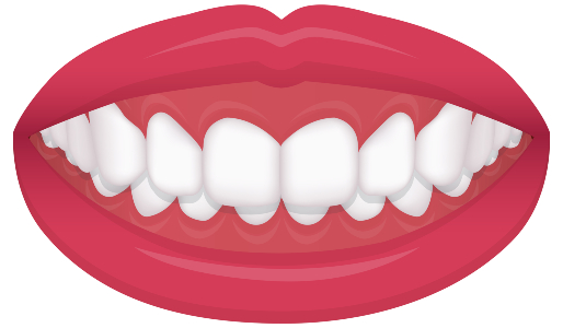 OVERBITE GRAPHIC OVERLAPPING TEETH TROUBLE BITE