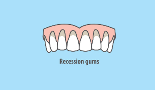 RECESSION GUMS GINGIVITIS PERIODONTITIS GUM DISEASE DRAWING